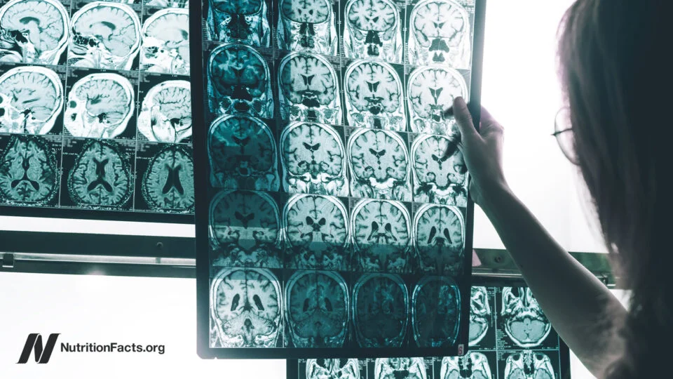 Link Between Pesticide Exposure and Alzheimer's Disease Risk Grows Stronger